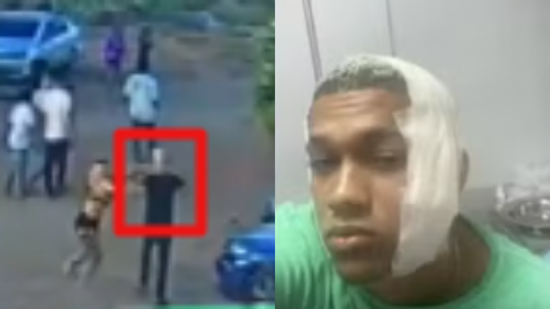 Jovem é agredido com uma garrafa de vidro no rosto após tentar separar briga e leva 37 pontos