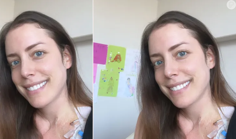 Fabiana Justus’ hair begins to fall out due to cancer treatment and the influencer takes a photo