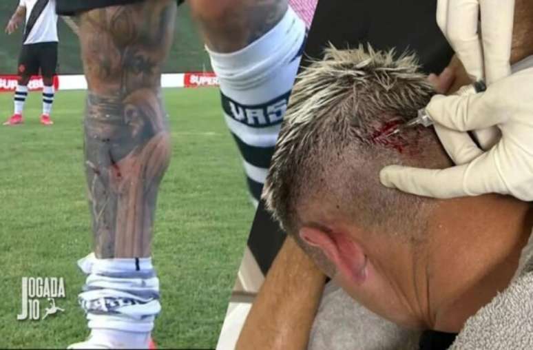 The beginning of Vasco’s career in Carioca is full of complaints about refereeing