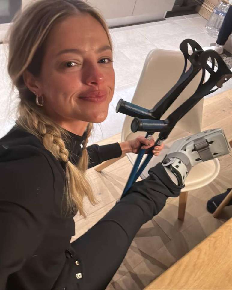 Agatha Moreira hurts her foot while traveling in France Agatha Moreira hurts her foot while traveling in France