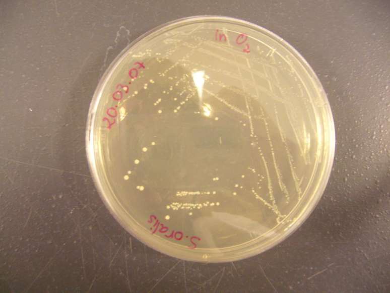 Bactérias do gênero Streptococcus, que costumam habitar a boca (Imagem: Djihed/Wikimedia Commons)