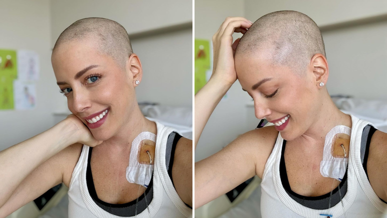 Em tratamento contra leucemia, Fabiana Justus raspa cabelo e compartilha relato emocionante
