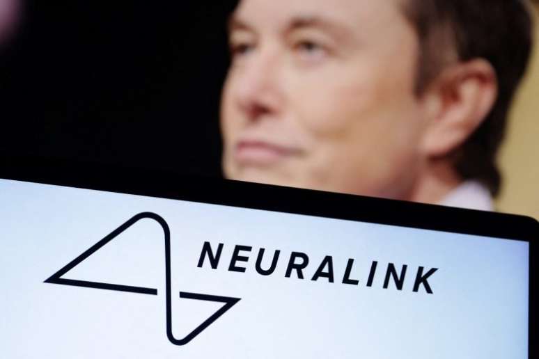Empresa do bilionário Elon Musk está investindo em implante cerebral 