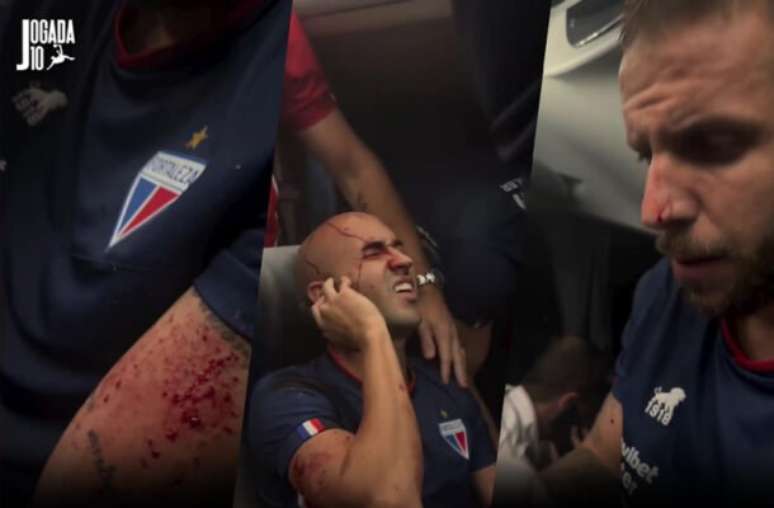 Fotos: Reprodução Instagram @marcelopaz - Legenda: Jogadores do Fortaleza acabaram feridos em ataque, após duelo contra o Sport