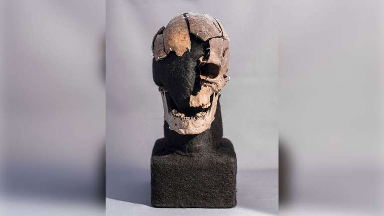 The teeth reveal the secrets of Vittrup Man, who died 5,000 years ago
