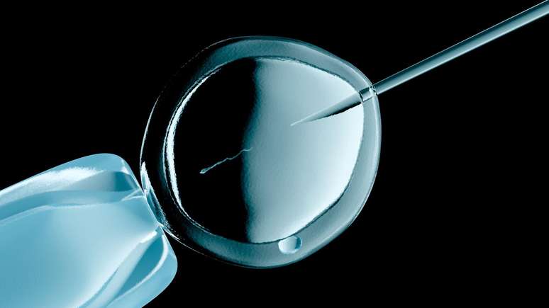 Nas clínicas de FIV, embriões que não atendem aos critérios necessários para serem transferidos para o útero são rotineiramente destruídos