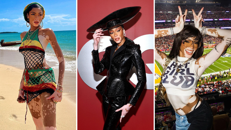 Winnie Harlow (Fotos: Reprodu&ccedil;&atilde;o/Instagram)