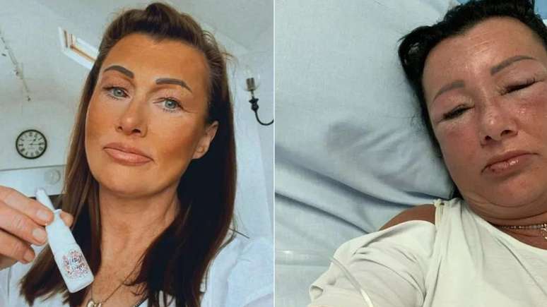 Woman hospitalized after using inhalable “Barbie Tanner”.