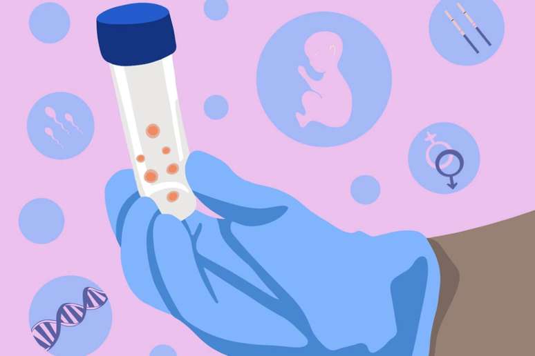 O Conselho Federal de Medicina recomenda que a fertilização in vitro seja realizada até os 50 anos 