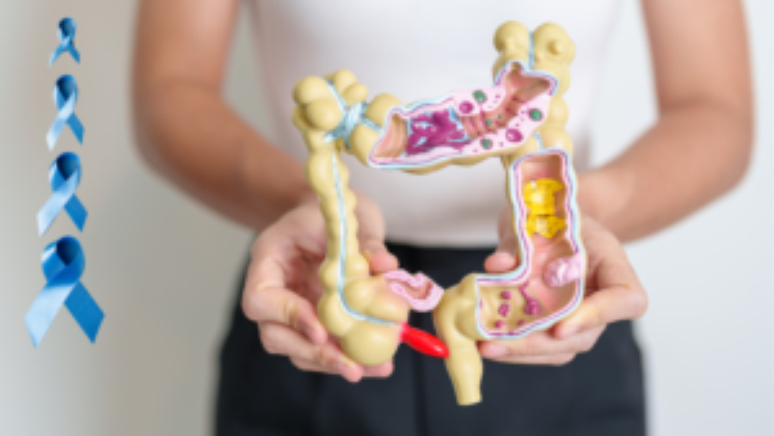 Mar&ccedil;o Azul contra o C&acirc;ncer Colorretal