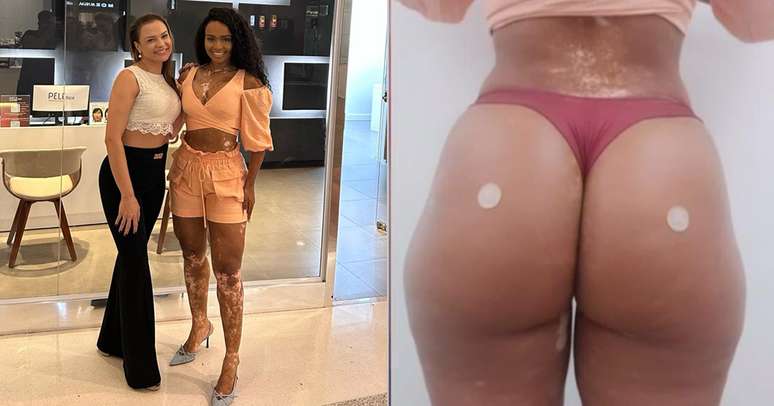 Nat&aacute;lia Deodato &mdash;