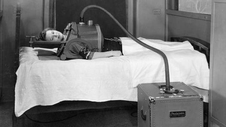 O pulm&atilde;o de ferro foi um marco no desenvolvimento dos ventiladores mec&acirc;nicos