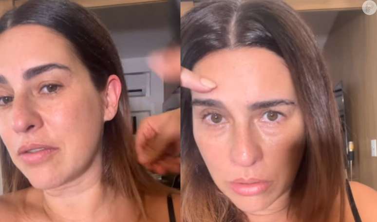 In the last stretch of her pregnancy, Fernanda Paes Leme shows a ‘clean face’ and the reality of skin without aesthetic procedures: ‘Imperfections’