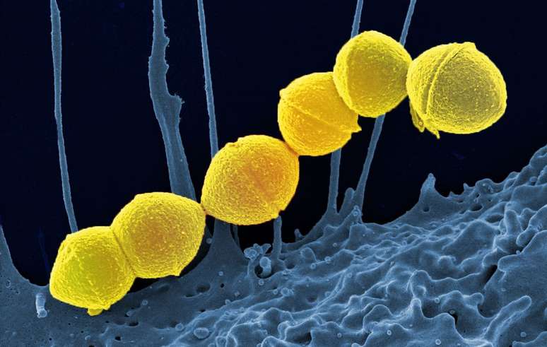 連鎖球菌トキシックショック症候群を引き起こし、致死性の可能性がある細菌が日本で増殖（画像：NIAID/CC-BY-2.0）