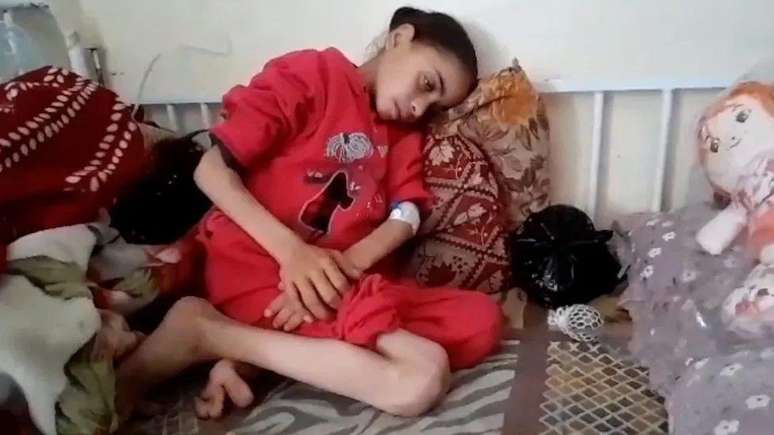 Noora Mohammed não consegue obter o tratamento que precisa em um hospital de Gaza