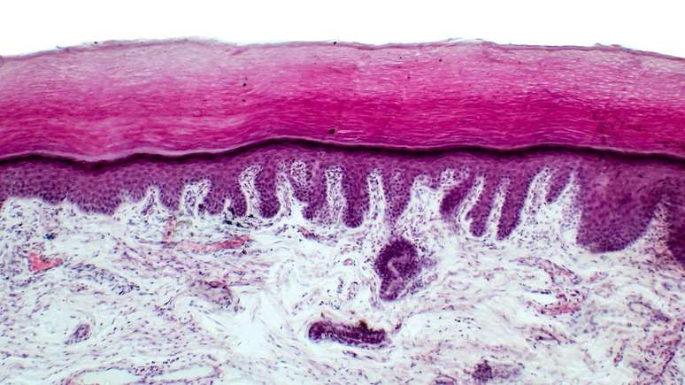 Muitos ingredientes cosméticos não conseguem penetrar na epiderme, a camada superior da pele