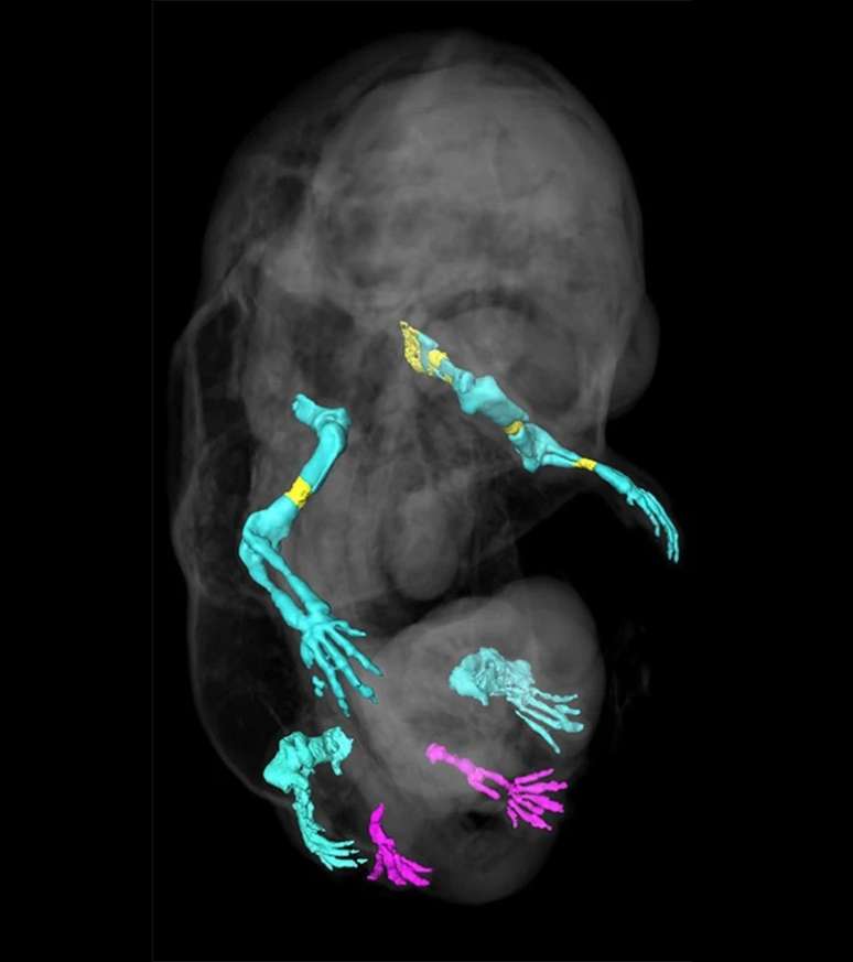 Estrutura genética define se células formarão genitais ou patas 