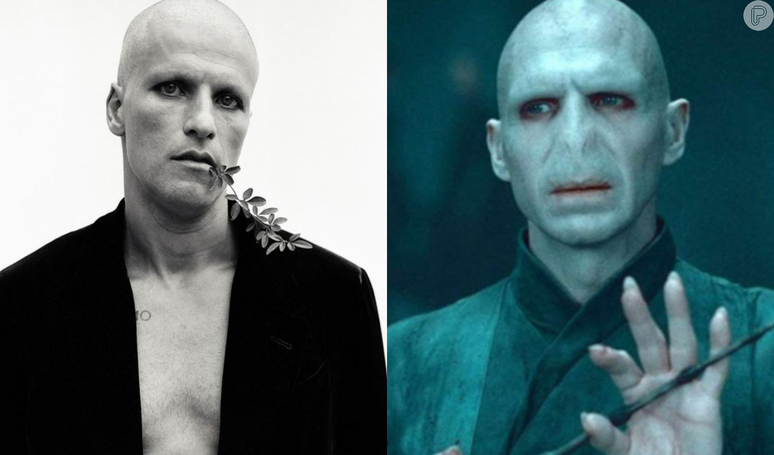 Bruno Gagliasso, bald and 14 kg lighter, is compared to the villain from ‘Harry Potter’ for his new look: ‘Are you Voldemort?’