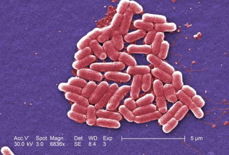 Nova classe de antibióticos vai combater as superbactérias, como a E. coli (Imagem: Janice Haney Carr/CDC)
