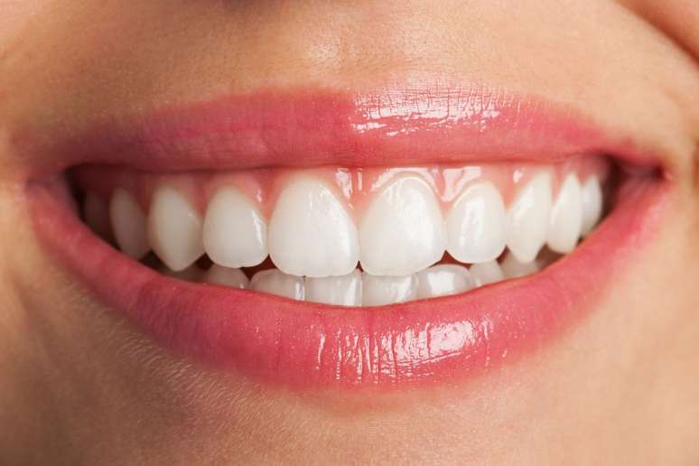 Saiba o que fazer para manter os resultados do clareamento dental |