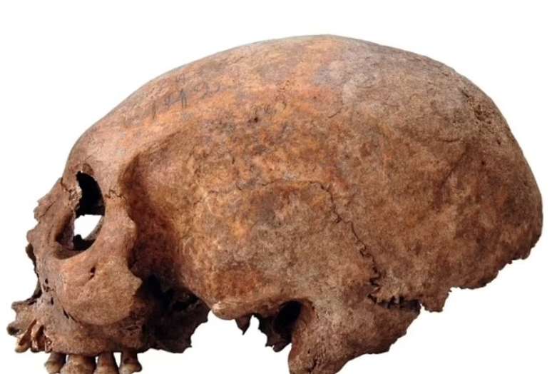 Pesquisadores encontraram crânios alongados de mulheres vikings