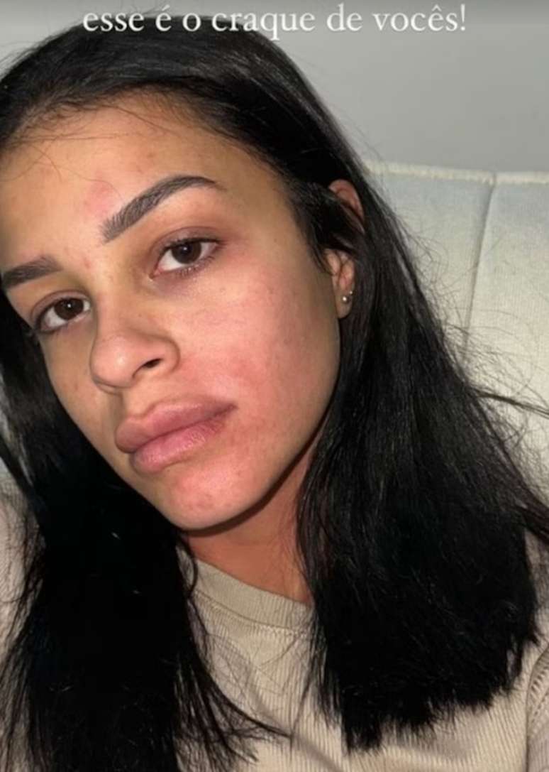 Isabella, ex-namorada de Kauê, faz denúncia de agressão física que teria sofrido