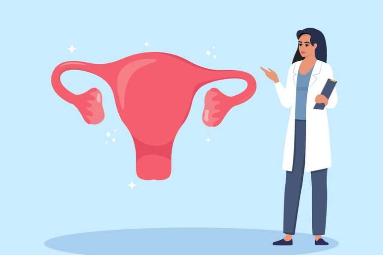 7 questions and answers about adenomyosis