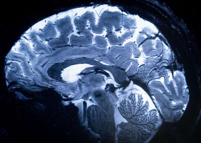 O encéfalo inclui o cérebro, o tronco encefálico e o cerebelo