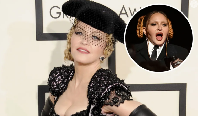 Quantas cirurgias plásticas Madonna tem? Antes e depois da jornada de procedimentos estéticos da rainha do pop.