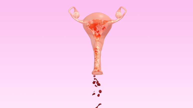 Será que é possível voltar a menstruar dois anos após a menopausa?