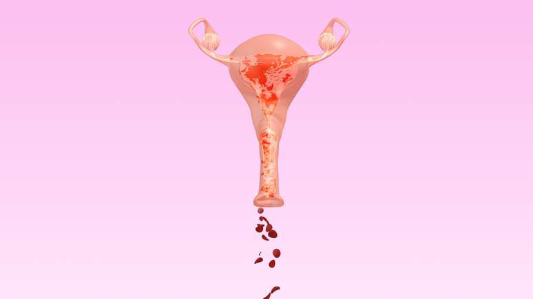 Is bleeding two years after menopause normal?