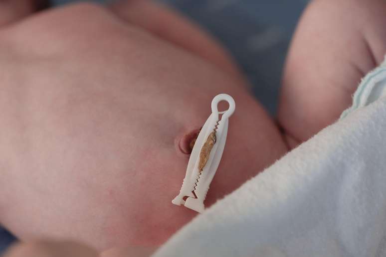 Após o corte do cordão umbilical, este pequeno coto que resta pode ser útil para bebês que nascem com problemas de saúde
