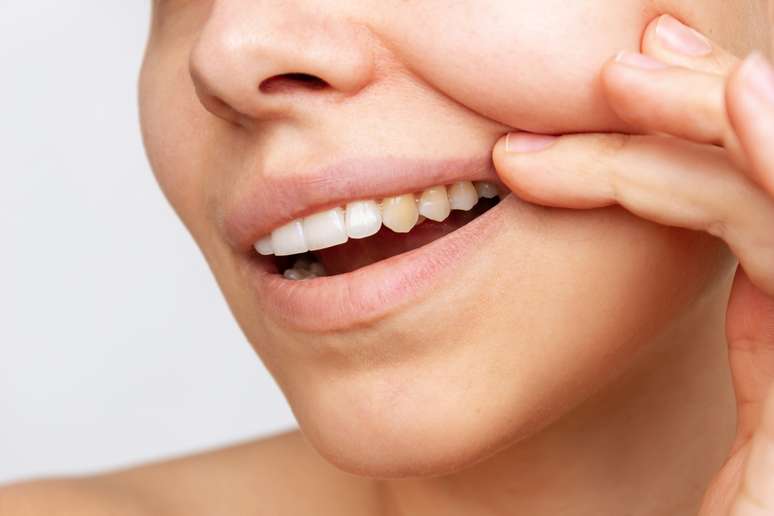 A cor natural dos dentes é influenciada por vários fatores