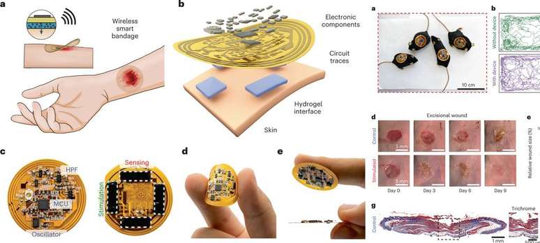 Curativo inteligente apresentado em estudo (Imagem: Yuanwen et al/Nature Biotechnology)