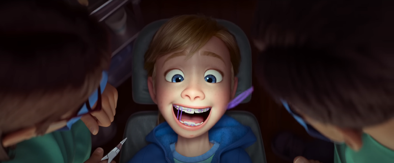 The purple rubber bands he wears at the dentist indicate that he is afraid. (Disclosure/Disney) The purple rubber bands he wears at the dentist indicate that he is afraid. (Disclosure/Disney)