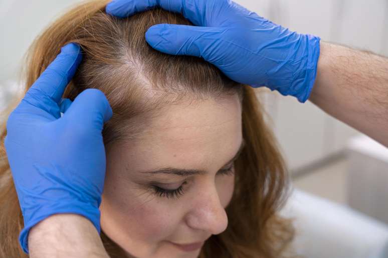 As descobertas demonstraram aumentos duradouros no crescimento do cabelo