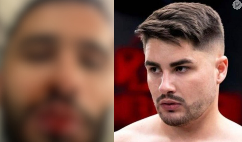 Ex de Lucas Souza detalha briga que terminou em agressão e exibe fotos do rosto ensanguentado.
