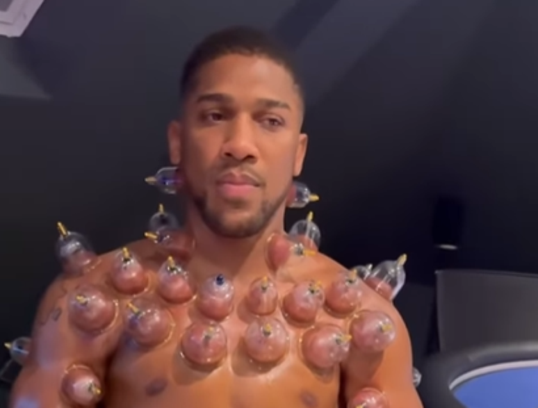 Anthony Joshua surpreende fãs com tratamento 