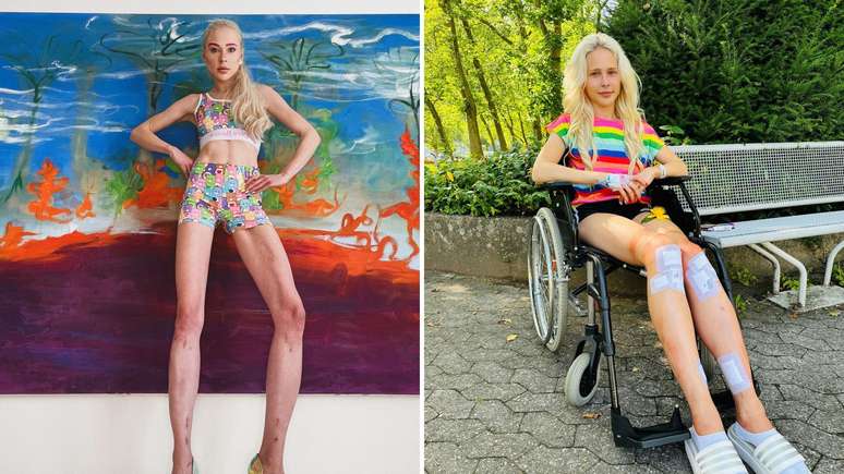 The model has had eight surgeries in the past eight years