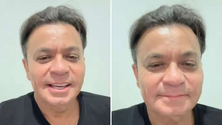 Frank Aguiar mostra manutenção de harmonização facial: 'carinha de 33'