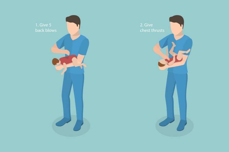 A manobra de Heimlich pode salvar a vida do bebê engasgado 