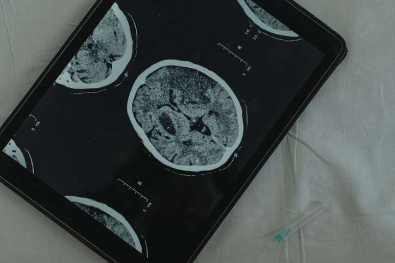 Studi meningkatkan pemahaman tentang pembersihan otak (Gambar: Tima Miroshnichenko/Pexels)