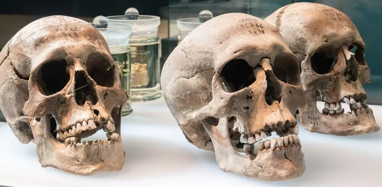 Três crânios e cérebros humanos (em segundo plano) foram encontrados em Cornaux/Les Sauges.