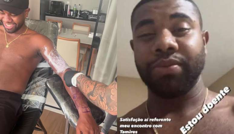 Campeão do BBB 24 revelou que teve febre e mal-estar após finalizar tatuagem no braço