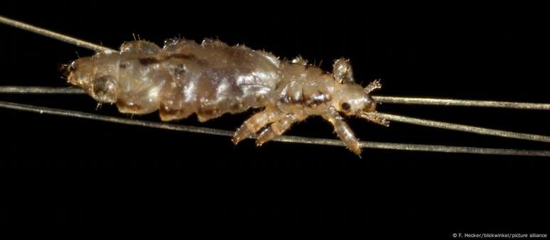 How to get rid of lice