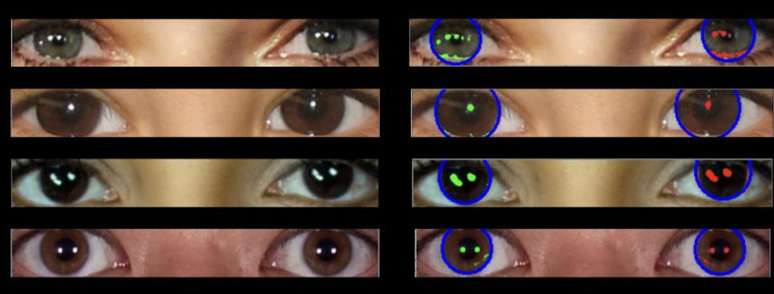 Imagens mostram reflexos de luz consistentes em ambos os olhos.