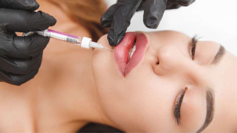 O microagulhamento labial ajuda a rejuvenescer os lábios