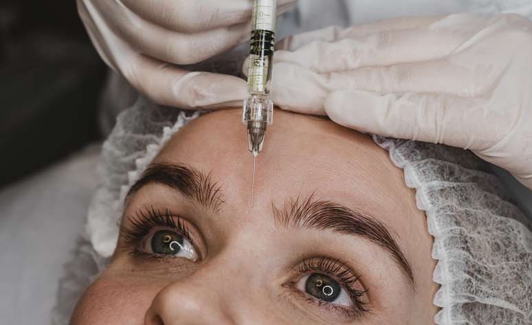 Profissional aponta de quanto em quanto tempo é indicado retocar o botox