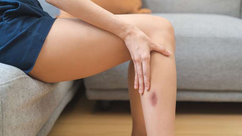 Manchas roxas na pele podem exigir avaliação médica