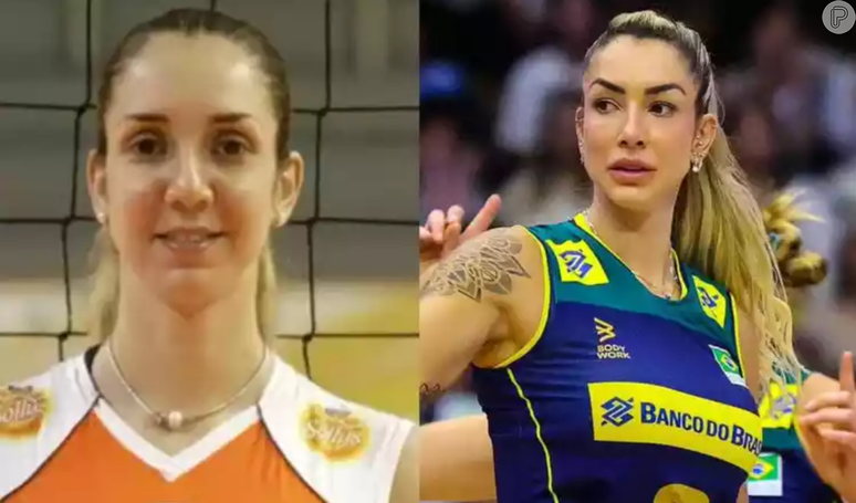 Tha&iacute;sa Daher fez rinoplastia, colocou silicone e harmonizou o rosto em 10 anos: a mudan&ccedil;a radical da jogadora de v&ocirc;lei.